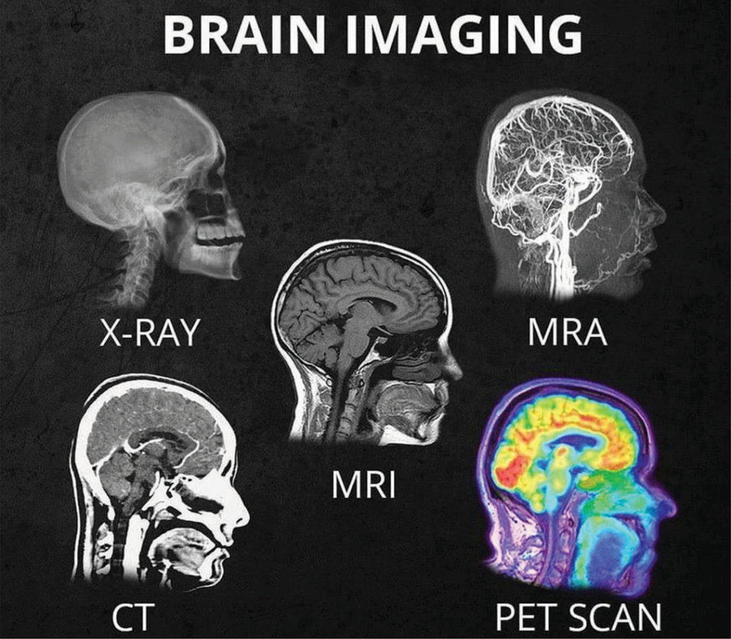 what-s-the-difference-between-all-the-different-head-scans-x-ray-ct