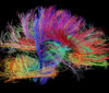 Brain image (Photo/Courtesy of USC Stevens Institute for Neuroimaging and Informatics)