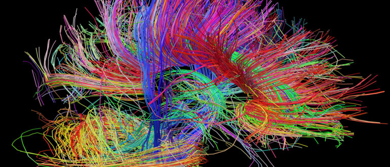 Brain image (Photo/Courtesy of USC Stevens Institute for Neuroimaging and Informatics)